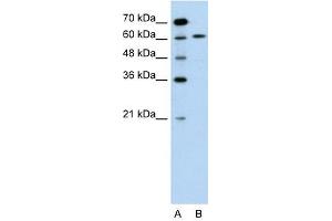 Western Blot showing PDCD8 antibody used at a concentration of 1-2 ug/ml to detect its target protein. (AIF 抗体  (N-Term))
