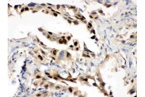 IHC analysis of Hsp70 using anti-Hsp70 antibody (ABIN3043849).