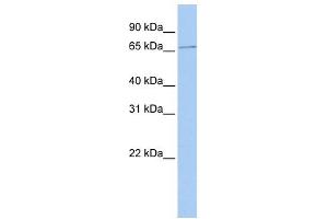 WB Suggested Anti-SCMH1 Antibody Titration: 0. (SCMH1 抗体  (Middle Region))
