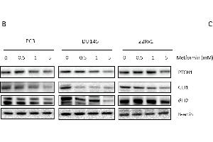 Link between metformin and Hedgehog signaling. (GLI2 抗体  (AA 30-65))