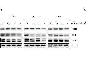 Link between metformin and Hedgehog signaling. (GLI2 抗体  (Internal Region))