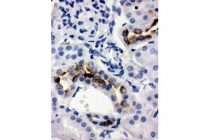 Anti-Kallikrein 1 antibody, IHC(P) IHC(P): Rat Kidney Tissue (Kallikrein 1 抗体  (C-Term))
