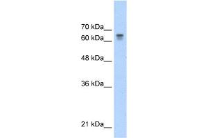WB Suggested Anti-PAntibody Titration:  0. (PARP6 抗体  (C-Term))