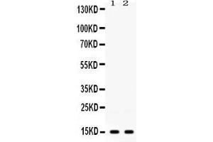 Western blot analysis of ISG15 expression in 22RV1 whole cell lysates ( Lane 1) and HELA whole cell lysates ( Lane 2). (ISG15 抗体  (AA 2-157))