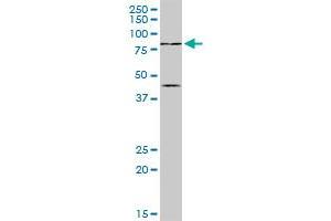 PIAS2 MaxPab rabbit polyclonal antibody. (PIAS2 抗体  (AA 1-572))