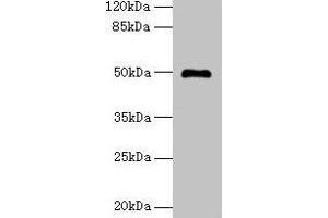 Western blot All lanes: ADAL antibody at 6 μg/mL + Mouse kidney tissue Secondary Goat polyclonal to rabbit IgG at 1/10000 dilution Predicted band size: 41, 31, 38 kDa Observed band size: 50 kDa (ADAL 抗体  (AA 1-267))