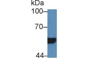 Detection of HNF1b in Human Serum using Polyclonal Antibody to Hepatocyte Nuclear Factor 1 Beta (HNF1b) (HNF1B 抗体  (AA 159-300))