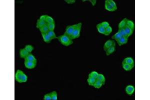 Immunofluorescent analysis of PC-3 cells using ABIN7162039 at dilution of 1:100 and Alexa Fluor 488-congugated AffiniPure Goat Anti-Rabbit IgG(H+L) (NME3 抗体  (AA 20-169))
