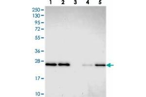 Western blot analysis of Lane 1: RT-4, Lane 2: U-251 MG, Lane 3: Human Plasma, Lane 4: Liver, Lane 5: Tonsil with GDF6 polyclonal antibody . (GDF6 抗体)