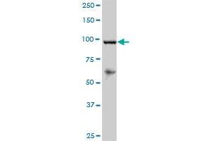 RECK MaxPab polyclonal antibody. (RECK 抗体  (AA 1-971))