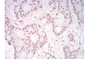 Immunohistochemical analysis of paraffin-embedded HeLa tissues using DDX39B mouse mAb with DAB staining.