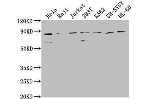 Western Blot Positive WB detected in: Hela whole cell lysate, Raji whole cell lysate, Jurkat whole cell lysate, 293T whole cell lysate, K562 whole cell lysate, SH-SY5Y whole cell lysate, HL-60 whole cell lysate All lanes: ZRANB1 antibody at 1:2000 Secondary Goat polyclonal to rabbit IgG at 1/50000 dilution Predicted band size: 81 kDa Observed band size: 81 kDa (ZRANB1 抗体  (AA 111-397))