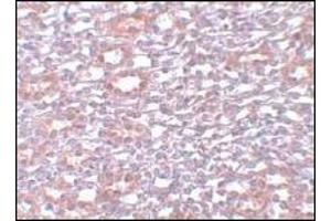 Immunohistochemistry of PIAS1 in rat kidney tissue with PIAS1 Antibody  at 5 μg/ml (PIAS1 抗体  (C-Term))