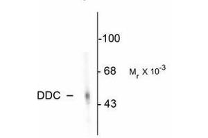 Image no. 2 for anti-Dopa Decarboxylase (Aromatic L-Amino Acid Decarboxylase) (DDC) antibody (ABIN220954) (DDC 抗体)