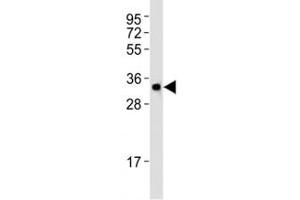 Western blot testing of Atg5 antibody at 1:1000 dilution + HT-1080 lysate.
