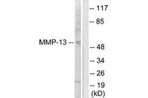 Western Blotting (WB) image for anti-Matrix Metallopeptidase 13 (Collagenase 3) (MMP13) (AA 10-59) antibody (ABIN2889227) (MMP13 抗体  (AA 10-59))