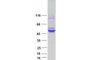 Western Blotting (WB) image for Melanoma Antigen Family A, 4 (MAGEA4) (Transcript Variant 1) protein (Myc-DYKDDDDK Tag) (ABIN2725177)