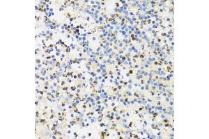 Immunohistochemistry of paraffin-embedded human appendicitis using SUMO4 Antibody (ABIN5971586) at dilution of 1/100 (40x lens). (SUMO4 抗体)
