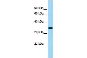 Host: Rabbit Target Name: SUCNR1 Sample Type: Fetal Heart lysates Antibody Dilution: 1. (SUCNR1 抗体  (Middle Region))