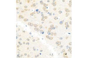 Immunohistochemistry analysis of paraffin embedded mouse brain using Erc2 (ABIN7073808) at dilution of 1: 3000 (ERC2 抗体)