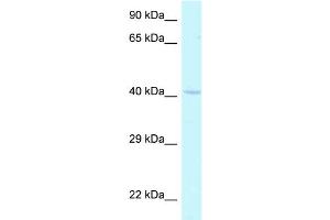 WB Suggested Anti-Hoxa2 Antibody Titration: 1.
