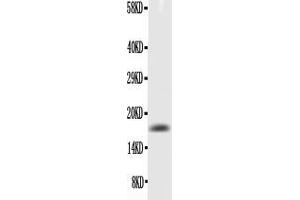 Western blot analysis of TNF alpha using anti- TNF alpha antibody . (TNF alpha 抗体  (AA 80-235))