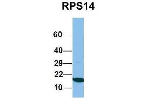 Western Blotting (WB) image for anti-Ribosomal Protein S14 (RPS14) (Middle Region) antibody (ABIN2778744)