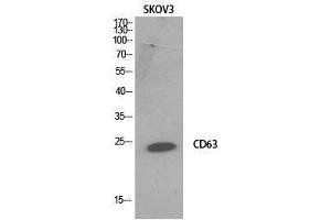 Western Blot (WB) analysis of SKOV3 cells using CD63 Polyclonal Antibody. (CD63 抗体  (Internal Region))