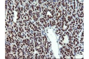 Image no. 1 for anti-Mannose Phosphate Isomerase (MPI) antibody (ABIN1499543) (MPI 抗体)