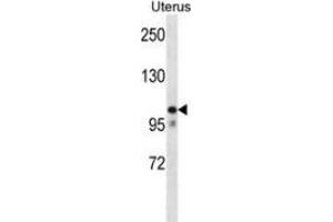 Western blot analysis in human normal Uterus cell line lysates (35ug/lane) using MOV10 Antibody (N-term). (MOV10 抗体  (N-Term))