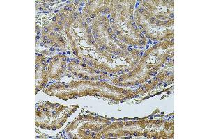 Immunohistochemistry of paraffin-embedded rat kidney using PDCD6IP antibody (ABIN1874065) at dilution of 1:100 (40x lens). (ALIX 抗体)