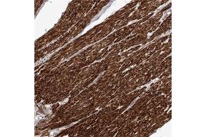 Immunohistochemical staining of human smooth muscle with FGFR4 polyclonal antibody  shows strong cytoplasmic positivity in smooth muscle cells at 1:50-1:200 dilution. (FGFR4 抗体)
