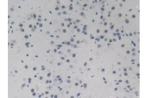 DAB staining on IHC-P; Samples: Mouse Brain Tissue (PHLDA2 抗体  (AA 9-140))
