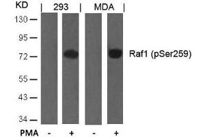 Western blot analysis of extracts from 293 and MDA cells untreated or treated with PMA using Raf1(Phospho-Ser259) Antibody. (RAF1 抗体  (pSer259))
