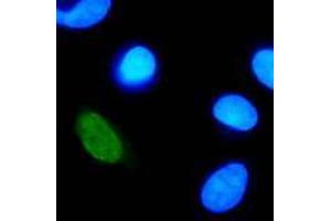 Immunofluorescence (IF) image for anti-Human Papilloma Virus Type 11 (HPV-11) (AA 202-284) antibody (ABIN781775) (人 Papilloma Virus Type 11 (HPV-11) (AA 202-284) 抗体)