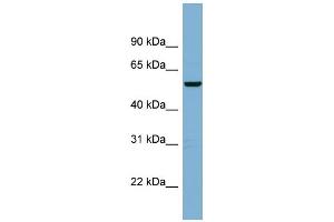 WB Suggested Anti-C2orf29 Antibody Titration: 0. (CNOT11 抗体  (Middle Region))
