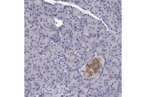 Immunohistochemical staining of human pancreas with KCND1 polyclonal antibody  shows moderate cytoplasmic positivity in Islet cells. (KCND1 抗体)