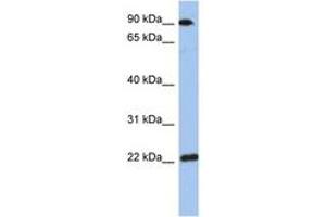 Image no. 1 for anti-Transmembrane Emp24-Like Trafficking Protein 10 (TMED10) (AA 143-192) antibody (ABIN6744308) (TMED10 抗体  (AA 143-192))