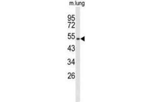 Western blot analysis of MUTYH (arrow) in mouse lung tissue lysates (35ug/lane) using MUTYH (MUTYH 抗体  (Middle Region))