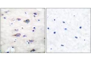 Immunohistochemistry (IHC) image for anti-Glutamate Receptor, Ionotropic, AMPA 2 (GRIA2) (pSer880) antibody (ABIN2888427) (GRIA2 抗体  (pSer880))