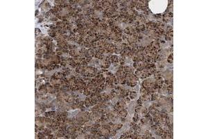 Immunohistochemical staining of human pancreas with CAMSAP1 polyclonal antibody  shows strong cytoplasmic positivity in exocrine glandular cells at 1:200-1:500 dilution. (CAMSAP1 抗体)
