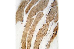 Formalin-fixed and paraffin-embedded human skeletal muscle tissue reacted with PDK4 antibody (Center D98) f , which was peroxidase-conjugated to the secondary antibody, followed by DAB staining. (PDK4 抗体  (AA 83-111))
