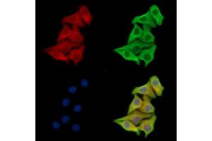 ABIN7097165 and ABIN7101233 staining Hela cells by IF/ICC. (XYLB 抗体)