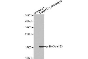 Western blot analysis of extracts from C2C12 cells, using Phospho-SNCA-Y133 antibody. (SNCA 抗体  (pTyr133))