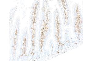 Immunohistochemistry (IHC) image for anti-CD48 (CD48) (AA 23-216) antibody (ABIN7795672) (Recombinant CD48 抗体  (AA 23-216))