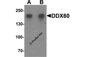 Western Blotting (WB) image for anti-DEAD (Asp-Glu-Ala-Asp) Box Polypeptide 60 (DDX60) antibody (ABIN1587945) (DDX60 抗体)