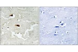 Immunohistochemistry analysis of paraffin-embedded human brain tissue, using NF-kappaB p65 (Ab-536) Antibody. (NF-kB p65 抗体  (AA 502-551))