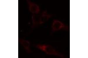 ABIN6274414 staining A549 cells by IF/ICC. (ADCK1 抗体  (Internal Region))