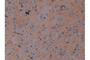 Detection of AQP4 in Mouse Cerebrum Tissue using Polyclonal Antibody to Aquaporin 4 (AQP4) (Aquaporin 4 抗体  (AA 177-304))