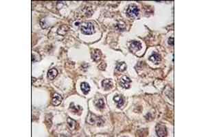 Image no. 1 for anti-Insulin Receptor-Related Receptor (INSRR) (N-Term) antibody (ABIN359888) (INSRR 抗体  (N-Term))